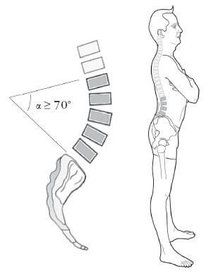 Иллюстрация к книге — Диагностика и лечение позвоночника. Уникальная система доктора А. М. Уриа [i_263.jpg]