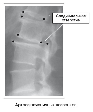 Иллюстрация к книге — Диагностика и лечение позвоночника. Уникальная система доктора А. М. Уриа [i_271.jpg]