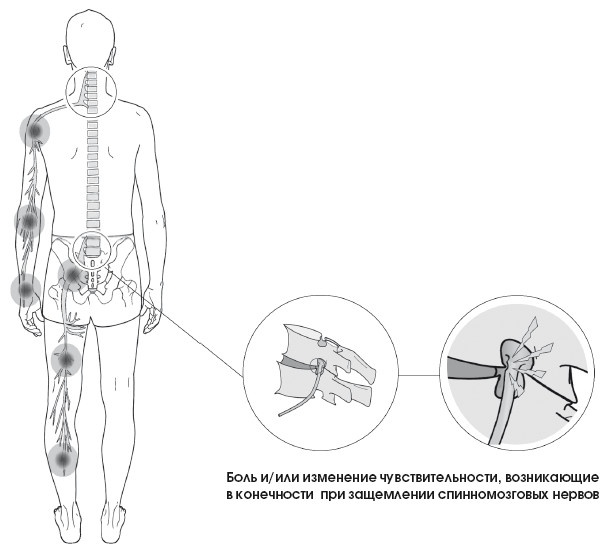 Иллюстрация к книге — Диагностика и лечение позвоночника. Уникальная система доктора А. М. Уриа [i_278.jpg]