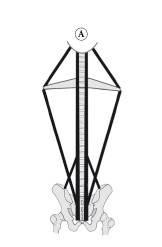 Иллюстрация к книге — Диагностика и лечение позвоночника. Уникальная система доктора А. М. Уриа [i_310.jpg]