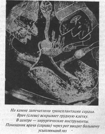 Иллюстрация к книге — Загадки острова Пасхи [i_028.jpg]