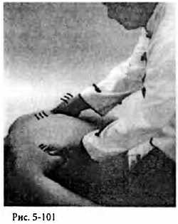 Иллюстрация к книге — Китайский цигун-массаж. Общий массаж [_101.jpg]