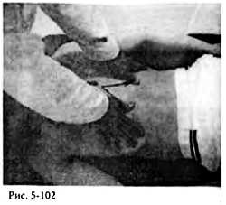 Иллюстрация к книге — Китайский цигун-массаж. Общий массаж [_102.jpg]