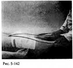 Иллюстрация к книге — Китайский цигун-массаж. Общий массаж [_142.jpg]