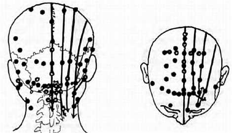 Иллюстрация к книге — Китайский цигун-массаж. Общий массаж [_16.jpg]