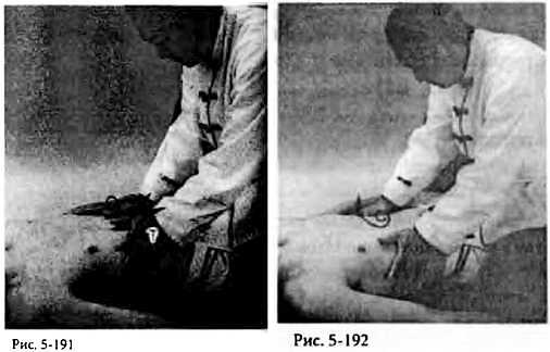 Иллюстрация к книге — Китайский цигун-массаж. Общий массаж [_192.jpg]