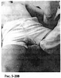 Иллюстрация к книге — Китайский цигун-массаж. Общий массаж [_208.jpg]