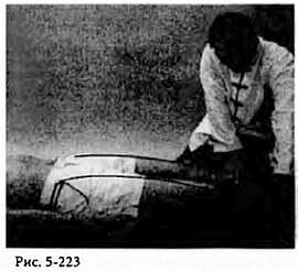 Иллюстрация к книге — Китайский цигун-массаж. Общий массаж [_223.jpg]