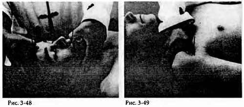 Иллюстрация к книге — Китайский цигун-массаж. Общий массаж [_49.jpg]