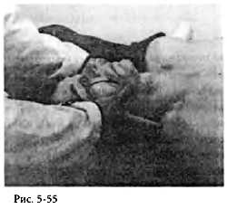 Иллюстрация к книге — Китайский цигун-массаж. Общий массаж [_55.jpg]