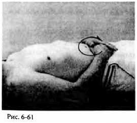 Иллюстрация к книге — Китайский цигун-массаж. Общий массаж [_61.jpg]