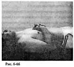 Иллюстрация к книге — Китайский цигун-массаж. Общий массаж [_66.jpg]