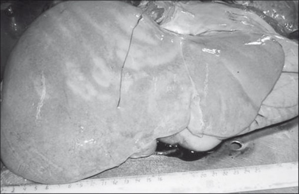 Иллюстрация к книге — Неалкогольная жировая болезнь печени [i_028.jpg]