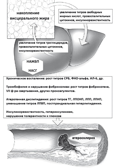Иллюстрация к книге — Неалкогольная жировая болезнь печени [i_035.jpg]