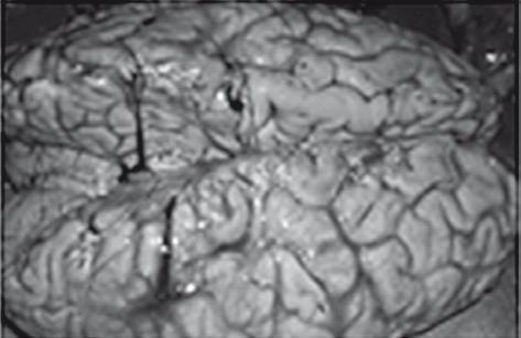 Иллюстрация к книге — Неалкогольная жировая болезнь печени [i_042.jpg]