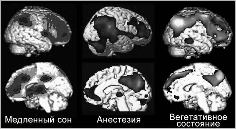 Иллюстрация к книге — Сознание и мозг. Как мозг кодирует мысли [i_035.jpg]