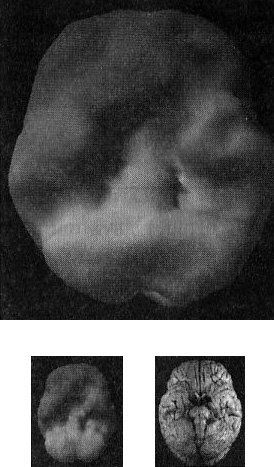 Иллюстрация к книге — Мозг. От хорошего к превосходному [i_010.jpg]