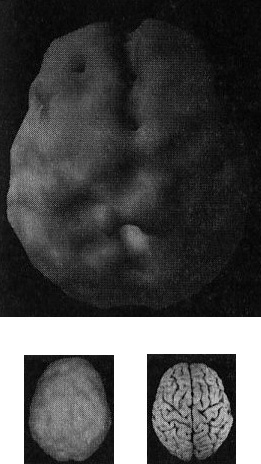 Иллюстрация к книге — Мозг. От хорошего к превосходному [img218.jpg]