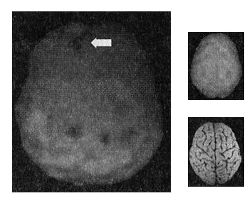 Иллюстрация к книге — Мозг. От хорошего к превосходному [img256copy.jpg]
