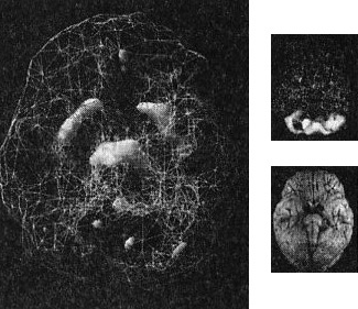 Иллюстрация к книге — Мозг. От хорошего к превосходному [img304copy3.jpg]