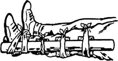 Иллюстрация к книге — Основы медицинских знаний и здорового образа жизни [_1_17.jpg]