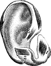 Иллюстрация к книге — Модицина. Encyclopedia Pathologica [_126.jpg]