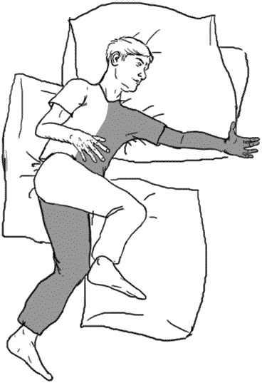 Иллюстрация к книге — Инсульт. Жизнь до и после [i_013.jpg]