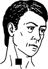 Иллюстрация к книге — Инсульт. Жизнь до и после [i_021.jpg]