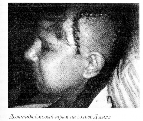 Иллюстрация к книге — Мой инсульт был мне наукой. История собственной болезни, рассказанная нейробиологом [_121322.jpg]