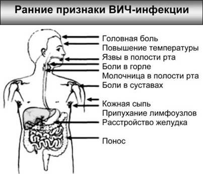 Иллюстрация к книге — Имя ему СПИД. Четвертый всадник Апокалипсиса [i_039.jpg]