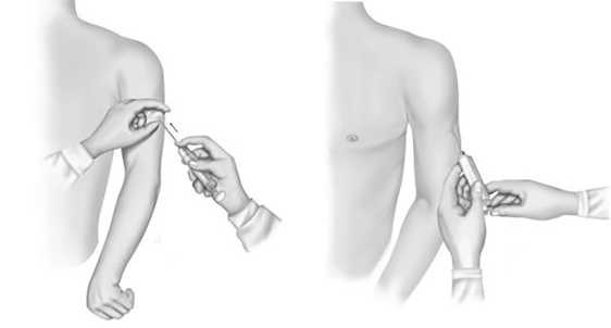 Иллюстрация к книге — Уколы, капельницы, перевязки и другие медицинские процедуры и манипуляции [i_015.jpg]