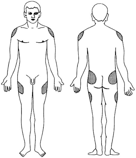 Иллюстрация к книге — Уколы, капельницы, перевязки и другие медицинские процедуры и манипуляции [i_017.jpg]