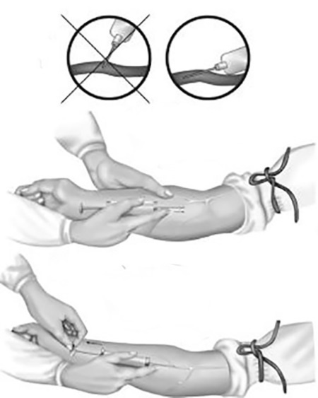 Иллюстрация к книге — Уколы, капельницы, перевязки и другие медицинские процедуры и манипуляции [i_018.jpg]