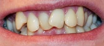 Иллюстрация к книге — Забыть стоматологов. Диеты. Симперцептинг [_2.jpg]