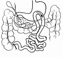 Иллюстрация к книге — Этюды желудочной хирургии [i_024.jpg]