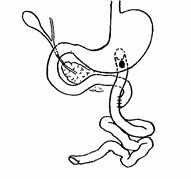 Иллюстрация к книге — Этюды желудочной хирургии [i_025.jpg]