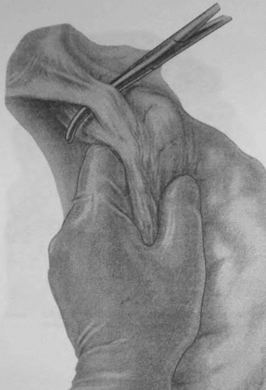 Иллюстрация к книге — Этюды желудочной хирургии [i_035.jpg]