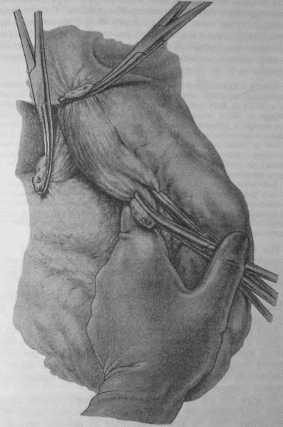 Иллюстрация к книге — Этюды желудочной хирургии [i_038.jpg]