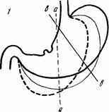 Иллюстрация к книге — Этюды желудочной хирургии [i_039.jpg]