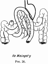 Иллюстрация к книге — Этюды желудочной хирургии [i_042.jpg]