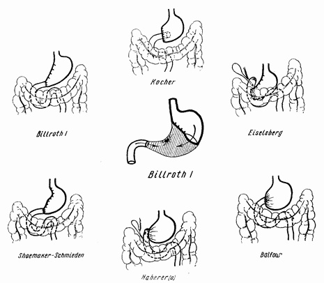 Иллюстрация к книге — Этюды желудочной хирургии [i_047.jpg]