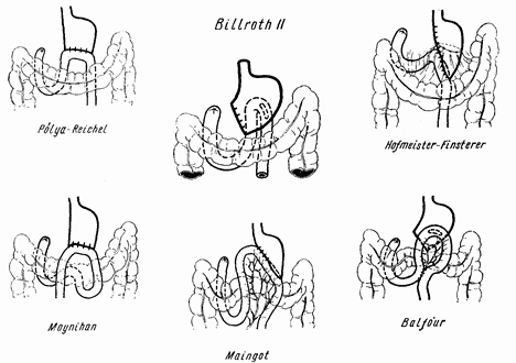 Иллюстрация к книге — Этюды желудочной хирургии [i_048.jpg]