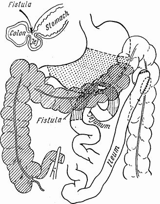 Иллюстрация к книге — Этюды желудочной хирургии [i_049.jpg]