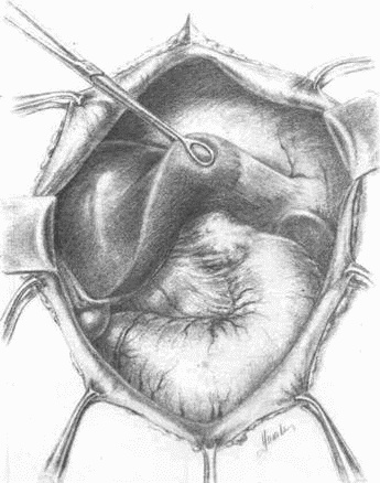 Иллюстрация к книге — Этюды желудочной хирургии [i_097.jpg]