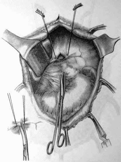Иллюстрация к книге — Этюды желудочной хирургии [i_100.jpg]