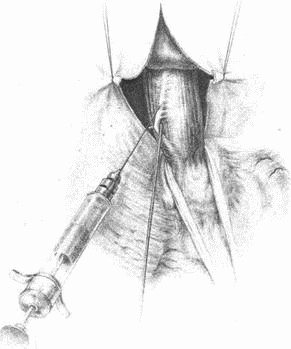 Иллюстрация к книге — Этюды желудочной хирургии [i_102.jpg]