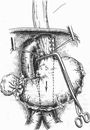 Иллюстрация к книге — Этюды желудочной хирургии [i_114.jpg]