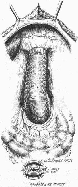 Иллюстрация к книге — Этюды желудочной хирургии [i_119.jpg]