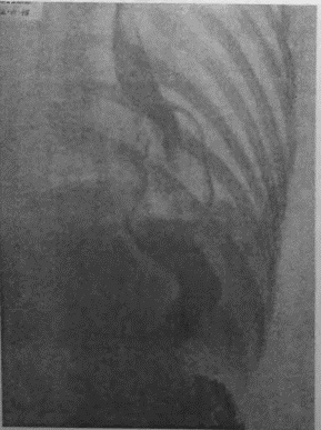 Иллюстрация к книге — Этюды желудочной хирургии [i_121.jpg]