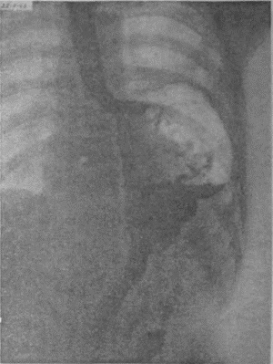 Иллюстрация к книге — Этюды желудочной хирургии [i_124.jpg]